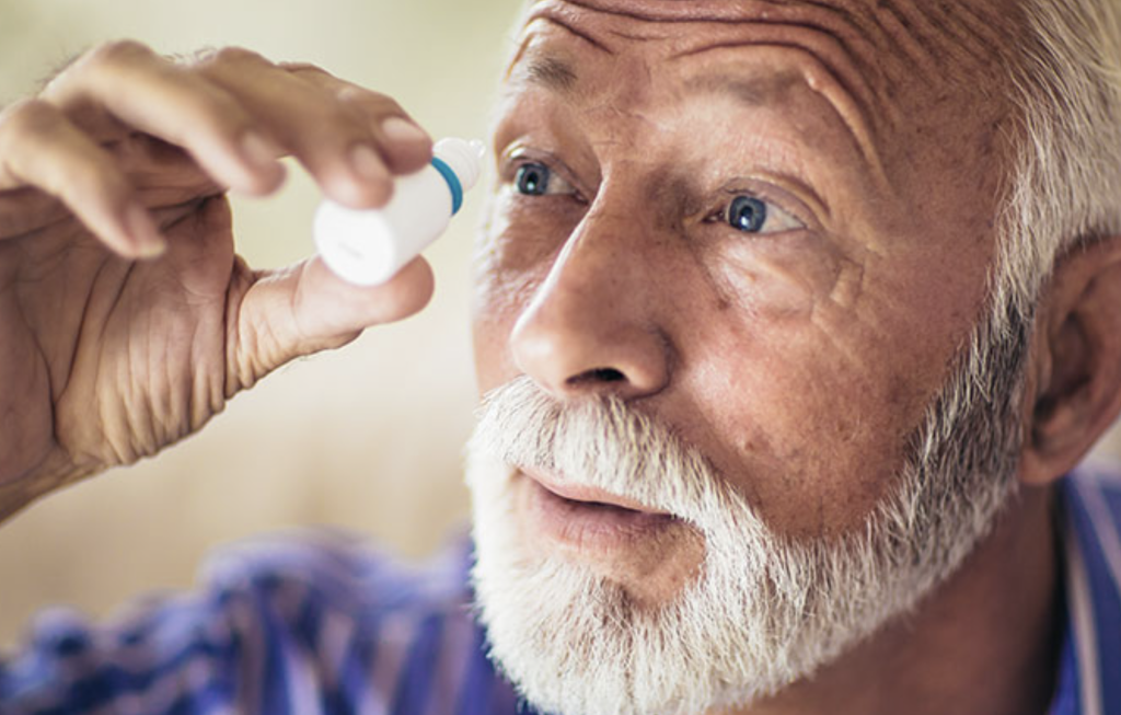 Conjuctivochalasis Wrinkled Eyeballs